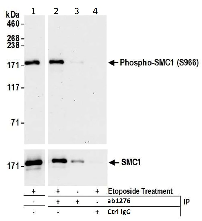Immunoprecipitation - Anti-SMC1A (phospho S966) antibody (AB1276)