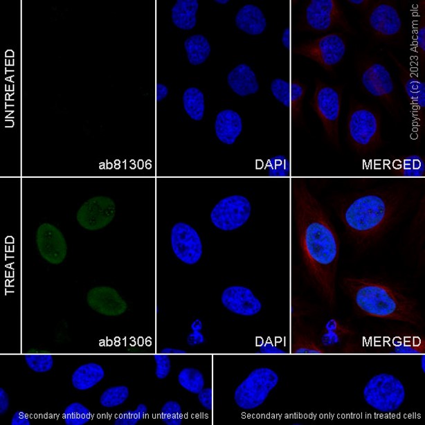 Immunocytochemistry/ Immunofluorescence - Anti-SMC1A (phospho S966) antibody [EP2858Y] (AB81306)