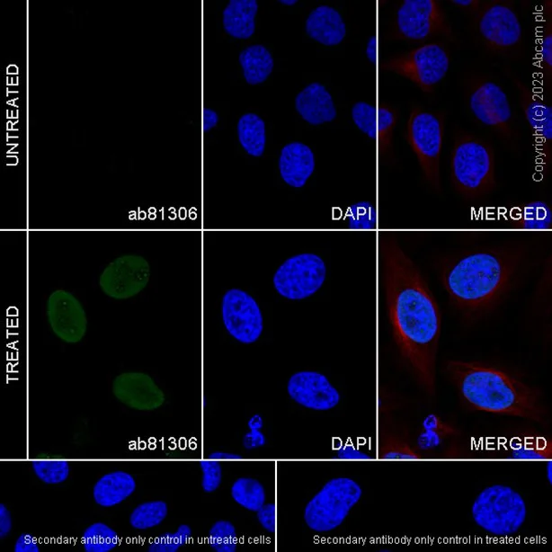 Immunocytochemistry/ Immunofluorescence - Anti-SMC1A (phospho S966) antibody [EP2858Y] (AB81306)
