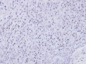 Immunohistochemistry (Formalin/PFA-fixed paraffin-embedded sections) - Anti-SMC1L2 antibody (AB96206)