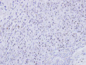 Immunohistochemistry (Formalin/PFA-fixed paraffin-embedded sections) - Anti-SMC1L2 antibody (AB96206)