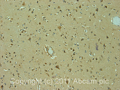 Immunohistochemistry (Formalin/PFA-fixed paraffin-embedded sections) - Anti-SMC2 antibody (AB10399), expandable thumbnail