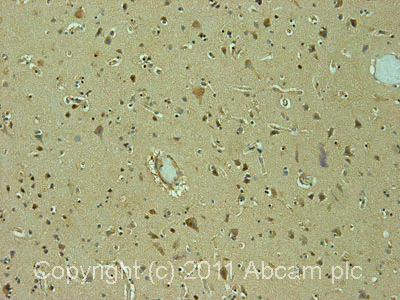 Immunohistochemistry (Formalin/PFA-fixed paraffin-embedded sections) - Anti-SMC2 antibody (AB10399)
