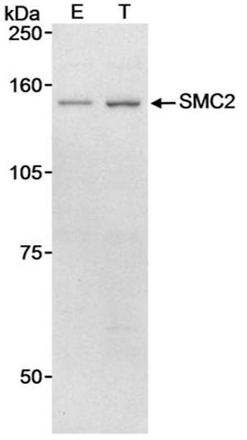 Western blot - Anti-SMC2 antibody (AB10399), expandable thumbnail
