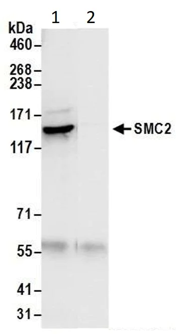 Immunoprecipitation - Anti-SMC2 antibody (AB10412)