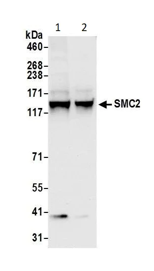 Western blot - Anti-SMC2 antibody (AB10412)