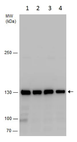 Western blot - Anti-SMC2 antibody (AB229353)