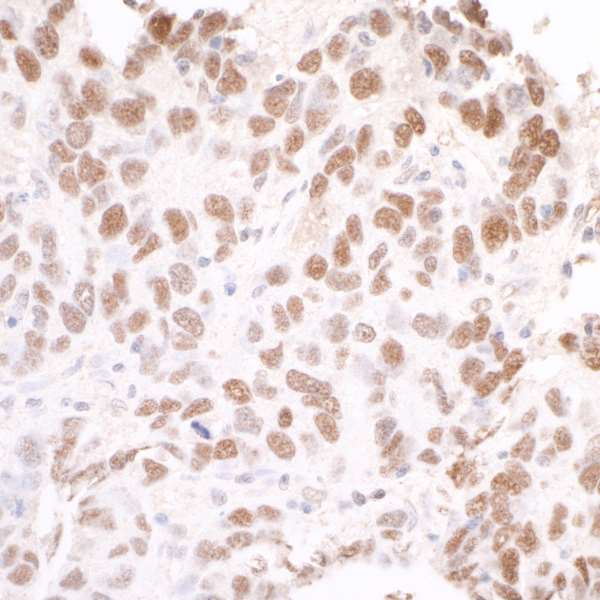 Anti-SMC3 antibody