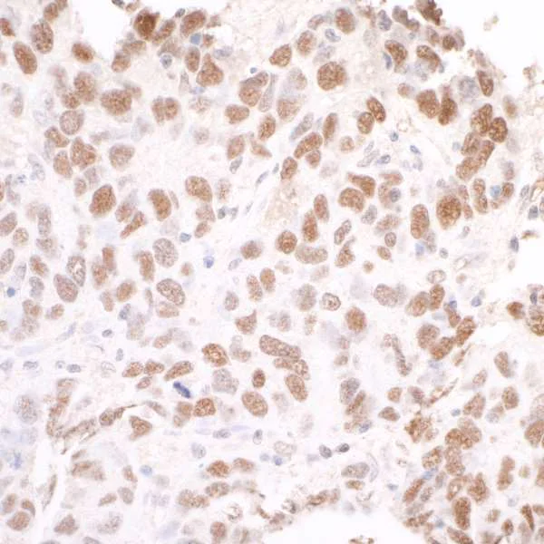 Immunohistochemistry (Formalin/PFA-fixed paraffin-embedded sections) - Anti-SMC3 antibody (AB9263)
