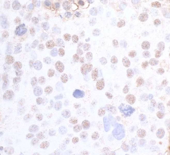 Immunohistochemistry (Formalin/PFA-fixed paraffin-embedded sections) - Anti-SMC3 antibody (AB9263)