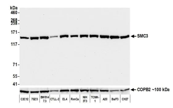 Western blot - Anti-SMC3 antibody [BLR099G] - BSA free (AB275963)