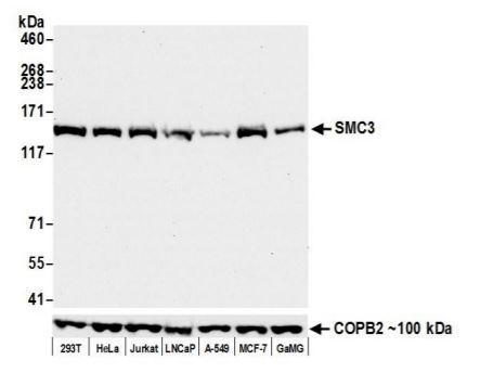 Western blot - Anti-SMC3 antibody [BLR099G] - BSA free (AB275963)