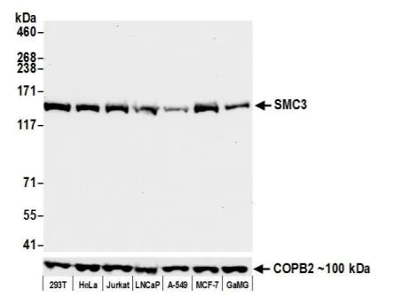 Western blot - Anti-SMC3 antibody [BLR099G] - BSA free (AB275963)