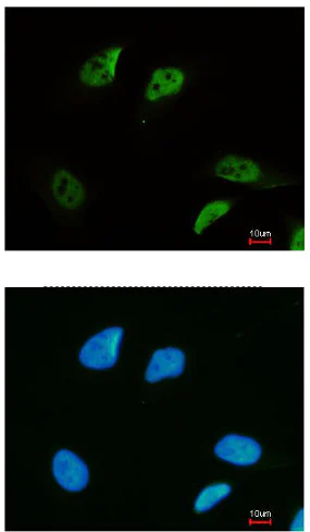 Immunocytochemistry/ Immunofluorescence - Anti-SMC3 antibody - C-terminal (AB155587)