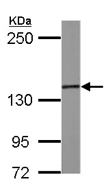 Western blot - Anti-SMC3 antibody - C-terminal (AB155587)