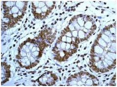 Immunohistochemistry (Formalin/PFA-fixed paraffin-embedded sections) - Anti-SMC3 antibody [EPR7984] - BSA and Azide free (AB225553)