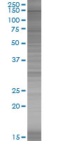 SDS-PAGE - SMC3 overexpression 293T lysate (whole cell) (AB94138)