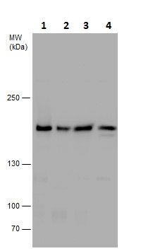 Western blot - Anti-SMC4 antibody - C-terminal (AB229480)
