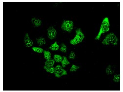 Immunocytochemistry/ Immunofluorescence - Anti-SMC4 antibody [EPR13366] - C-terminal (AB179831)