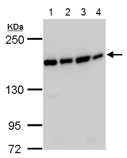 Western blot - Anti-SMC4 antibody - N-terminal (AB229213)