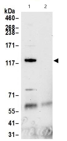 Immunoprecipitation - Anti-SMC5 antibody (AB18038)