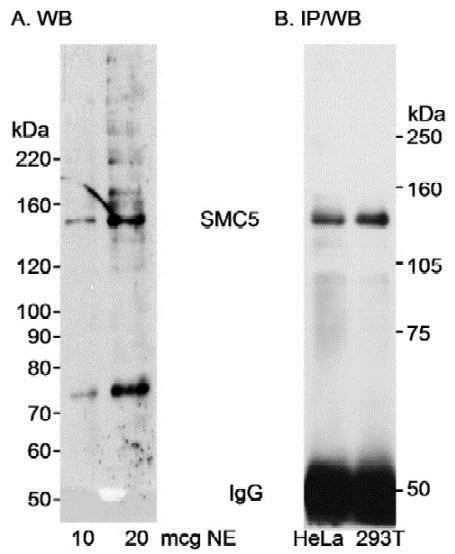 Western blot - Anti-SMC5 antibody (AB18038)