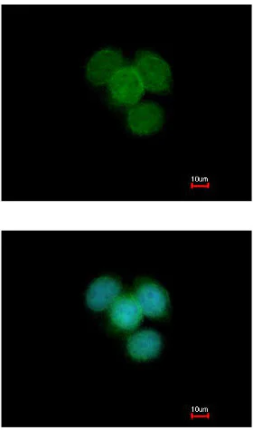Immunocytochemistry/ Immunofluorescence - Anti-SMC6 antibody (AB155495)