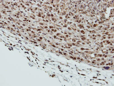 Immunohistochemistry (Formalin/PFA-fixed paraffin-embedded sections) - Anti-SMC6 antibody (AB155495)