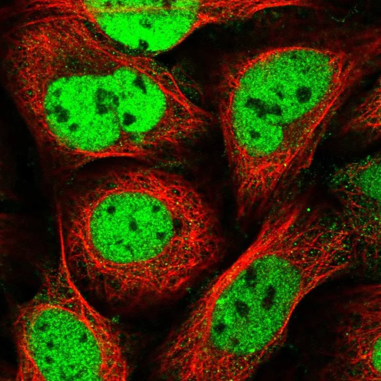 Immunocytochemistry/ Immunofluorescence - Anti-SMCHD1 antibody (AB122555)