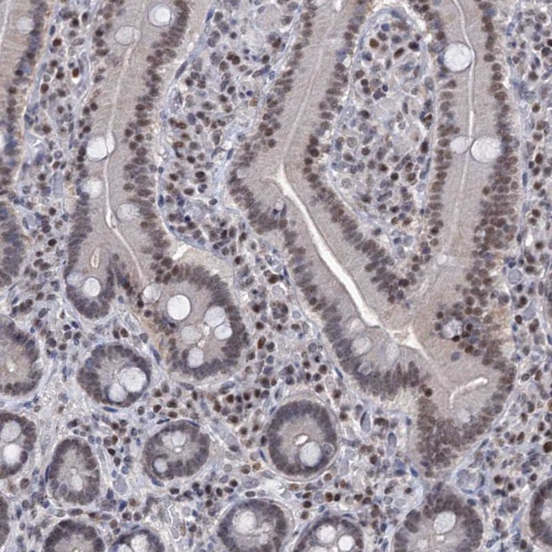 Immunohistochemistry (Formalin/PFA-fixed paraffin-embedded sections) - Anti-SMCHD1 antibody (AB122555)