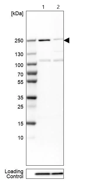Western blot - Anti-SMCHD1 antibody (AB122555)