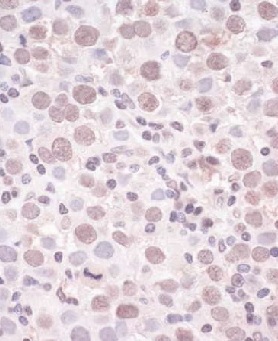 Immunohistochemistry (Formalin/PFA-fixed paraffin-embedded sections) - Anti-SMCHD1 antibody (AB176731)