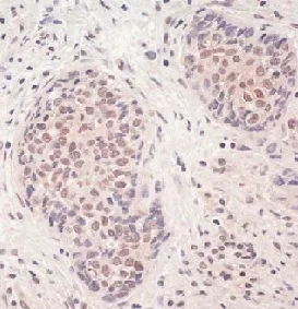 Immunohistochemistry (Formalin/PFA-fixed paraffin-embedded sections) - Anti-SMCHD1 antibody (AB176731)