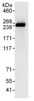Immunoprecipitation - Anti-SMCHD1 antibody (AB176731)