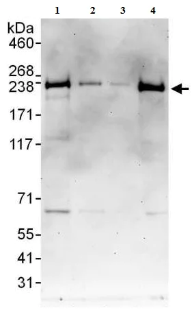 Western blot - Anti-SMCHD1 antibody (AB176731)