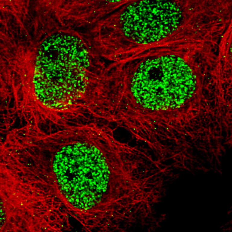 Immunocytochemistry/ Immunofluorescence - Anti-SMCHD1 antibody [CL4265] (AB220026)