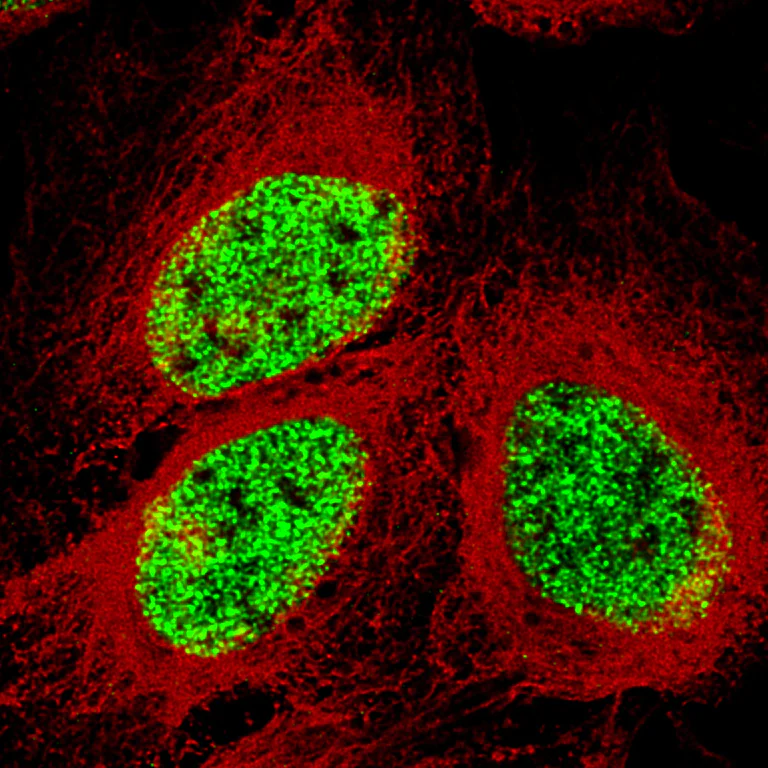 Immunocytochemistry/ Immunofluorescence - Anti-SMCHD1 antibody [CL4265] (AB220026)
