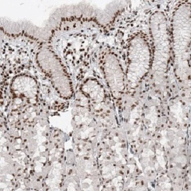 Immunohistochemistry (Formalin/PFA-fixed paraffin-embedded sections) - Anti-SMCHD1 antibody [CL4265] (AB220026)