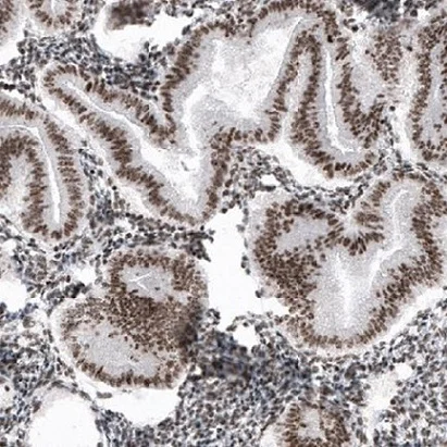 Immunohistochemistry (Formalin/PFA-fixed paraffin-embedded sections) - Anti-SMCHD1 antibody [CL4265] (AB220026)