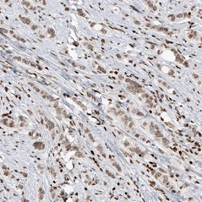 Immunohistochemistry (Formalin/PFA-fixed paraffin-embedded sections) - Anti-SMCHD1 antibody [CL4265] (AB220026)