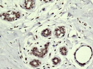 Immunohistochemistry (Formalin/PFA-fixed paraffin-embedded sections) - Anti-SMCHD1 antibody [EPR12340-29] (AB179456)