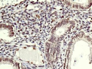 Immunohistochemistry (Formalin/PFA-fixed paraffin-embedded sections) - Anti-SMCHD1 antibody [EPR12340-29] (AB179456)