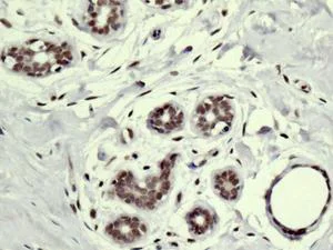 Immunohistochemistry (Formalin/PFA-fixed paraffin-embedded sections) - Anti-SMCHD1 antibody [EPR12340-29] - BSA and Azide free (AB250098)