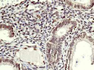 Immunohistochemistry (Formalin/PFA-fixed paraffin-embedded sections) - Anti-SMCHD1 antibody [EPR12340-29] - BSA and Azide free (AB250098)