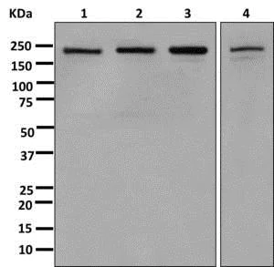 Western blot - Anti-SMCHD1 antibody [EPR12340-29] - BSA and Azide free (AB250098)
