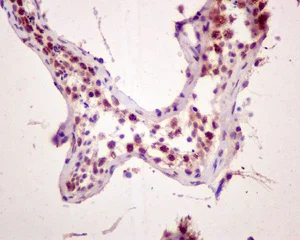 Immunohistochemistry (Formalin/PFA-fixed paraffin-embedded sections) - Anti-SMCHD1 antibody [EPR12340] (AB175235)