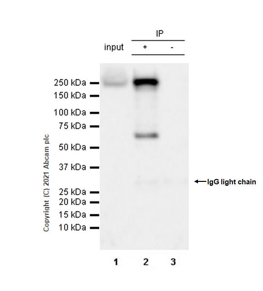 Immunoprecipitation - Anti-SMCHD1 antibody [EPR12340] (AB175235), expandable thumbnail