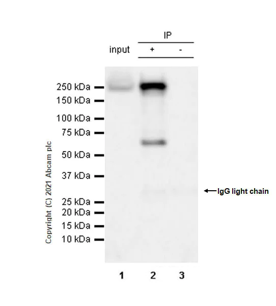 Immunoprecipitation - Anti-SMCHD1 antibody [EPR12340] (AB175235)