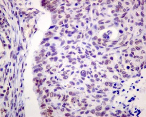 Immunohistochemistry (Formalin/PFA-fixed paraffin-embedded sections) - Anti-SMCHD1 antibody [EPR12340] - BSA and Azide free (AB249884)