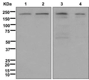 Western blot - Anti-SMCHD1 antibody [EPR12340] - BSA and Azide free (AB249884)